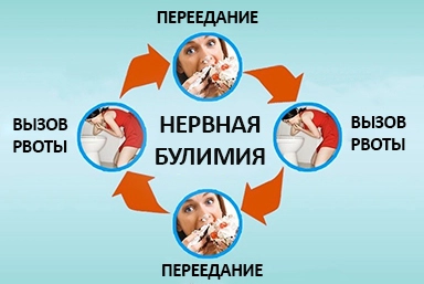 Лечение булимии в Якутске